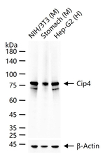 TRIP10 Antibody in Western Blot (WB)