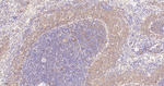 BLNK Antibody in Immunohistochemistry (Paraffin) (IHC (P))
