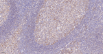 BLNK Antibody in Immunohistochemistry (Paraffin) (IHC (P))