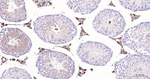 FDX1 Antibody in Immunohistochemistry (Paraffin) (IHC (P))