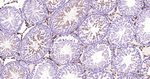 FDX1 Antibody in Immunohistochemistry (Paraffin) (IHC (P))