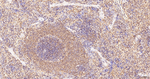 COPS8 Antibody in Immunohistochemistry (Paraffin) (IHC (P))