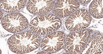 COPS8 Antibody in Immunohistochemistry (Paraffin) (IHC (P))