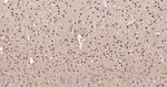 COPS8 Antibody in Immunohistochemistry (Paraffin) (IHC (P))