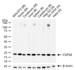 COPS8 Antibody in Western Blot (WB)