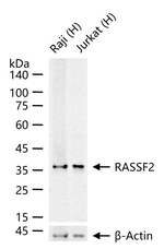 RASSF2 Antibody in Western Blot (WB)