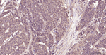MTAP Recombinant Rabbit Monoclonal Antibody (2A3)