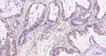 MTAP Antibody in Immunohistochemistry (Paraffin) (IHC (P))