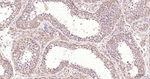 MTAP Antibody in Immunohistochemistry (Paraffin) (IHC (P))