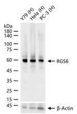 RGS6 Recombinant Rabbit Monoclonal Antibody (16C1)