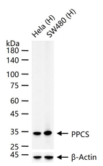 PPCS Antibody in Western Blot (WB)