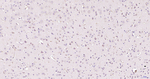 GRP78 Antibody in Immunohistochemistry (Paraffin) (IHC (P))