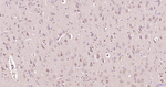 GRP78 Antibody in Immunohistochemistry (Paraffin) (IHC (P))