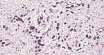 GRP78 Antibody in Immunohistochemistry (Paraffin) (IHC (P))