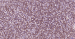 GRP78 Antibody in Immunohistochemistry (Paraffin) (IHC (P))