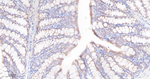 IGF2BP2 Antibody in Immunohistochemistry (Paraffin) (IHC (P))