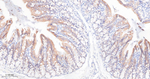 IGF2BP2 Antibody in Immunohistochemistry (Paraffin) (IHC (P))
