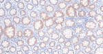 IGF2BP2 Antibody in Immunohistochemistry (Paraffin) (IHC (P))