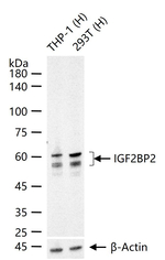 IGF2BP2 Antibody in Western Blot (WB)