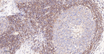 GNAI2 Antibody in Immunohistochemistry (Paraffin) (IHC (P))