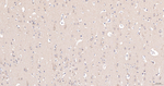 ITPK1 Antibody in Immunohistochemistry (Paraffin) (IHC (P))