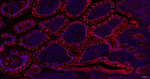 ITPK1 Recombinant Rabbit Monoclonal Antibody (3B8)