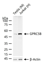 GPRC5B Recombinant Rabbit Monoclonal Antibody (5H9)
