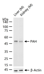 PAH Antibody in Western Blot (WB)