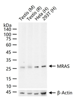 MRAS Recombinant Rabbit Monoclonal Antibody (6A8)