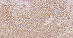 MDH2 Antibody in Immunohistochemistry (Paraffin) (IHC (P))