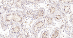 MDH2 Antibody in Immunohistochemistry (Paraffin) (IHC (P))