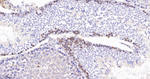 MDH2 Antibody in Immunohistochemistry (Paraffin) (IHC (P))