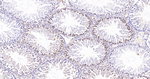 MDH2 Antibody in Immunohistochemistry (Paraffin) (IHC (P))