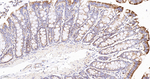 MDH2 Antibody in Immunohistochemistry (Paraffin) (IHC (P))
