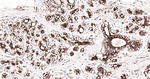 MDH2 Antibody in Immunohistochemistry (Paraffin) (IHC (P))