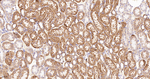 MDH2 Antibody in Immunohistochemistry (Paraffin) (IHC (P))
