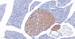 IFT88 Antibody in Immunohistochemistry (Paraffin) (IHC (P))