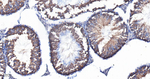 IFT88 Antibody in Immunohistochemistry (Paraffin) (IHC (P))
