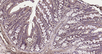 RAB8A Antibody in Immunohistochemistry (Paraffin) (IHC (P))