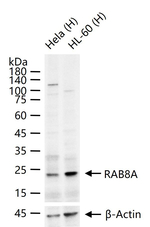 RAB8A Antibody in Western Blot (WB)