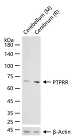 PCPTP1 Recombinant Rabbit Monoclonal Antibody (4A12)