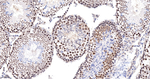 PPP2R5D Antibody in Immunohistochemistry (Paraffin) (IHC (P))