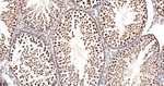 PPP2R5D Antibody in Immunohistochemistry (Paraffin) (IHC (P))