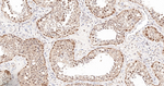 PPP2R5D Antibody in Immunohistochemistry (Paraffin) (IHC (P))
