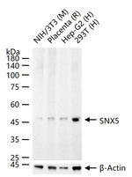 SNX5 Recombinant Rabbit Monoclonal Antibody (12A11)