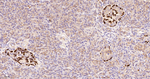 MYO1B Antibody in Immunohistochemistry (Paraffin) (IHC (P))