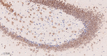 PCBP2 Recombinant Rabbit Monoclonal Antibody (14H1)