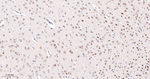 PCBP2 Antibody in Immunohistochemistry (Paraffin) (IHC (P))