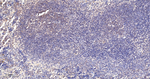 PCBP2 Antibody in Immunohistochemistry (Paraffin) (IHC (P))