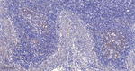 PCBP2 Antibody in Immunohistochemistry (Paraffin) (IHC (P))